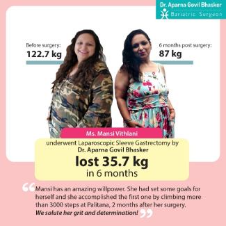 1_gastrectomy-2