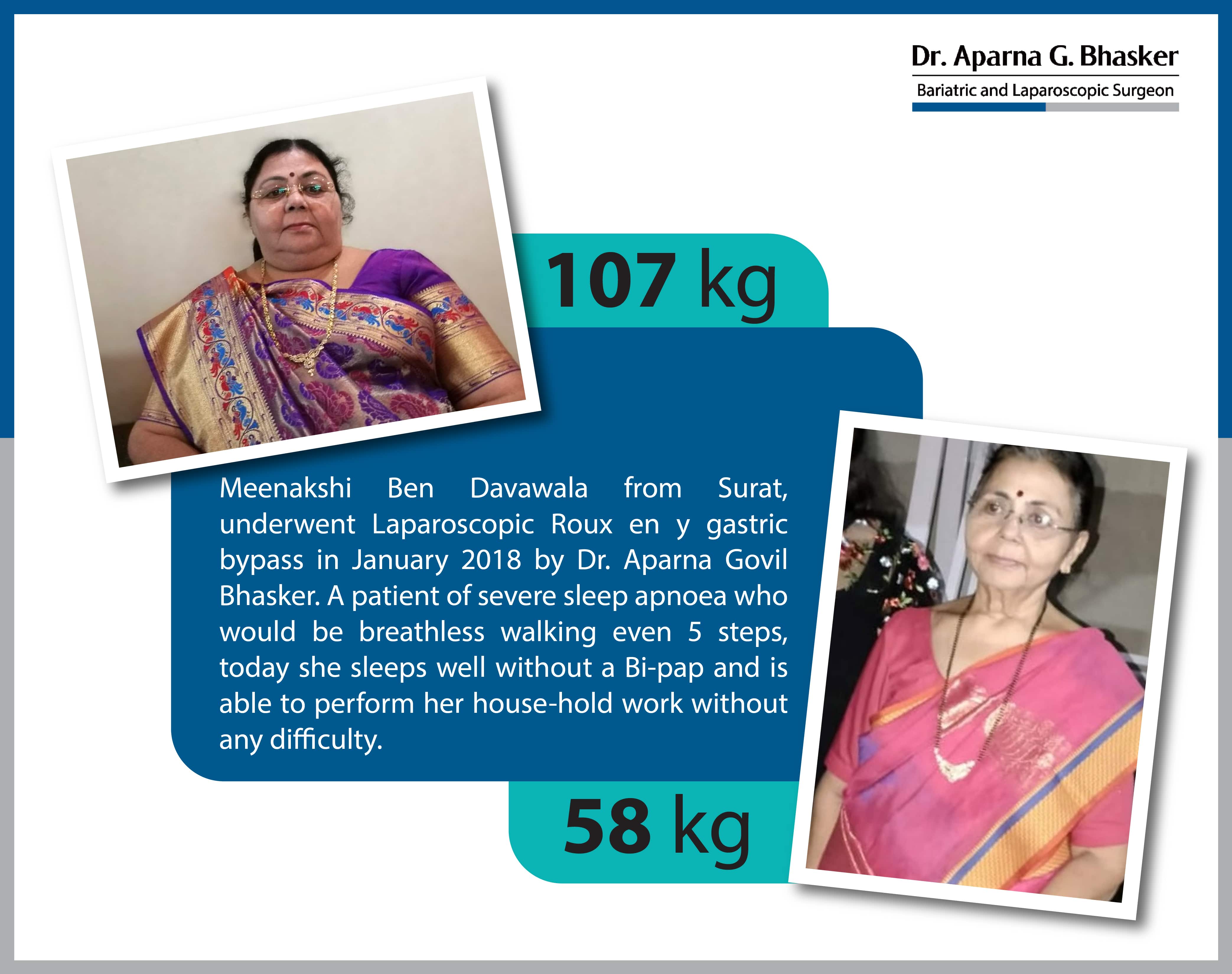 best Banded Roux-en Y Gastric Bypass bariatric surgery and weight loss surgery cost in mumbai india before after photos (4)