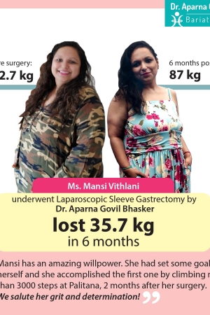 best Gastric Banding bariatric surgery and weight loss surgery cost in mumbai india before after photos (10)