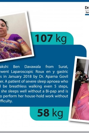 best Gastric Banding bariatric surgery and weight loss surgery cost in mumbai india before after photos (4)