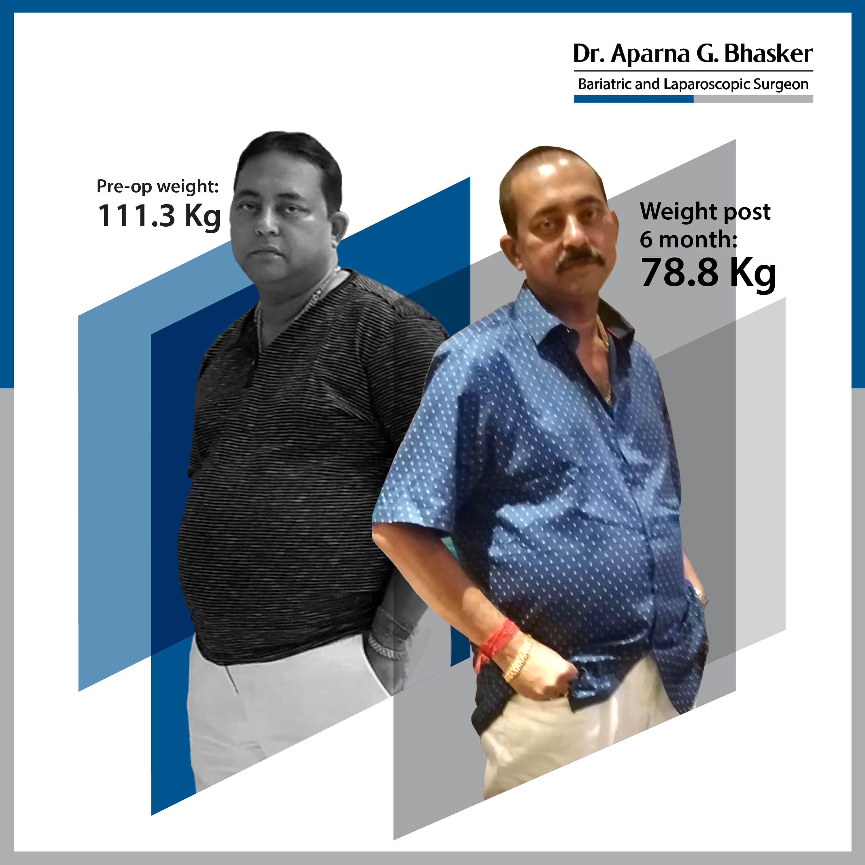 best Roux-en Y Gastric Bypass bariatric surgery and weight loss surgery cost in mumbai india before after photos (8)