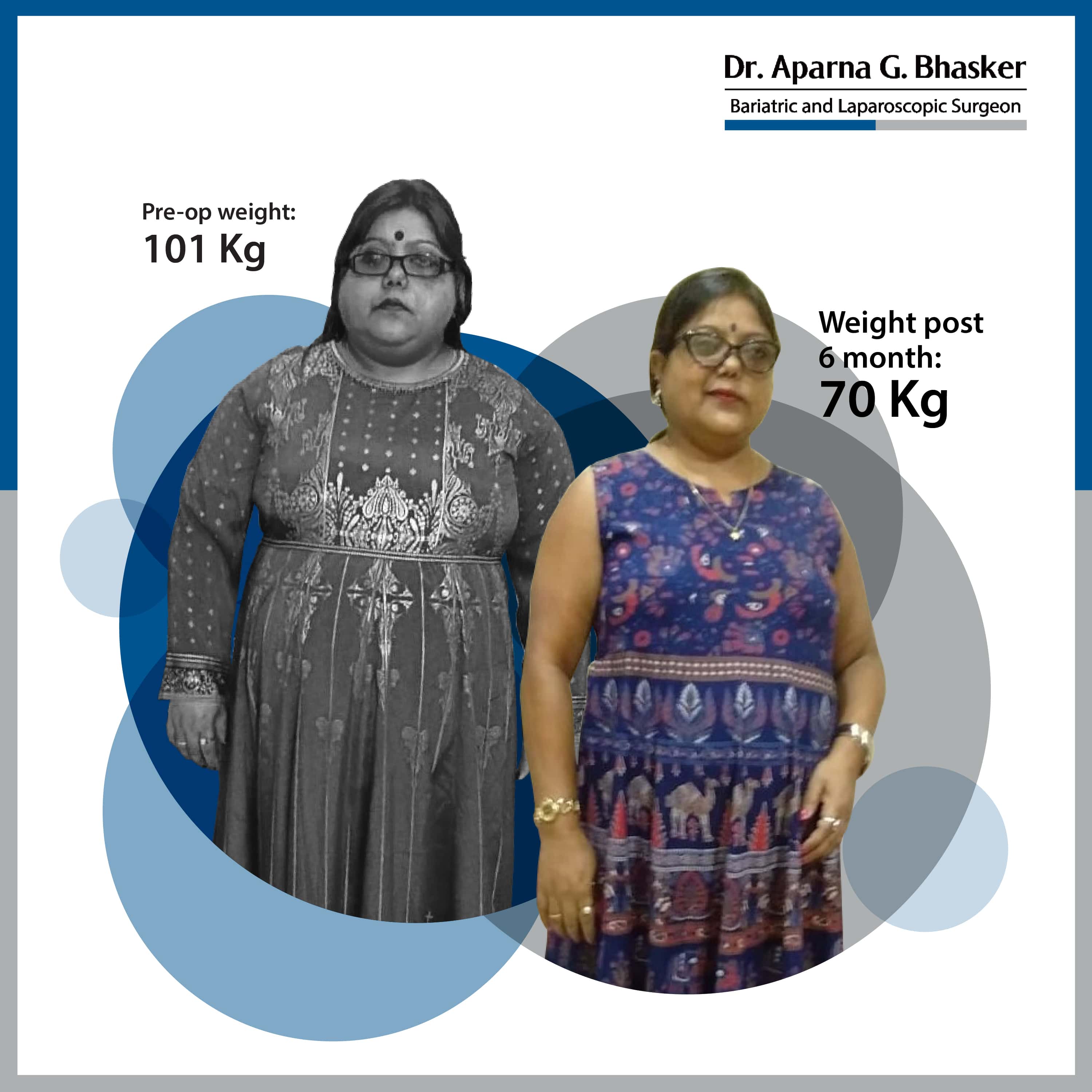 best Roux-en Y Gastric Bypass bariatric surgery and weight loss surgery cost in mumbai india before after photos (9)