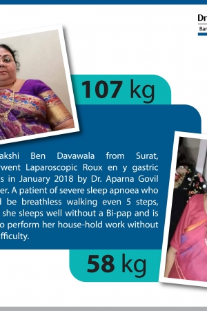 best Sleeve Gastrectomy with Duodeno Ileostomy bariatric surgery and weight loss surgery cost in mumbai india before after photos (4)