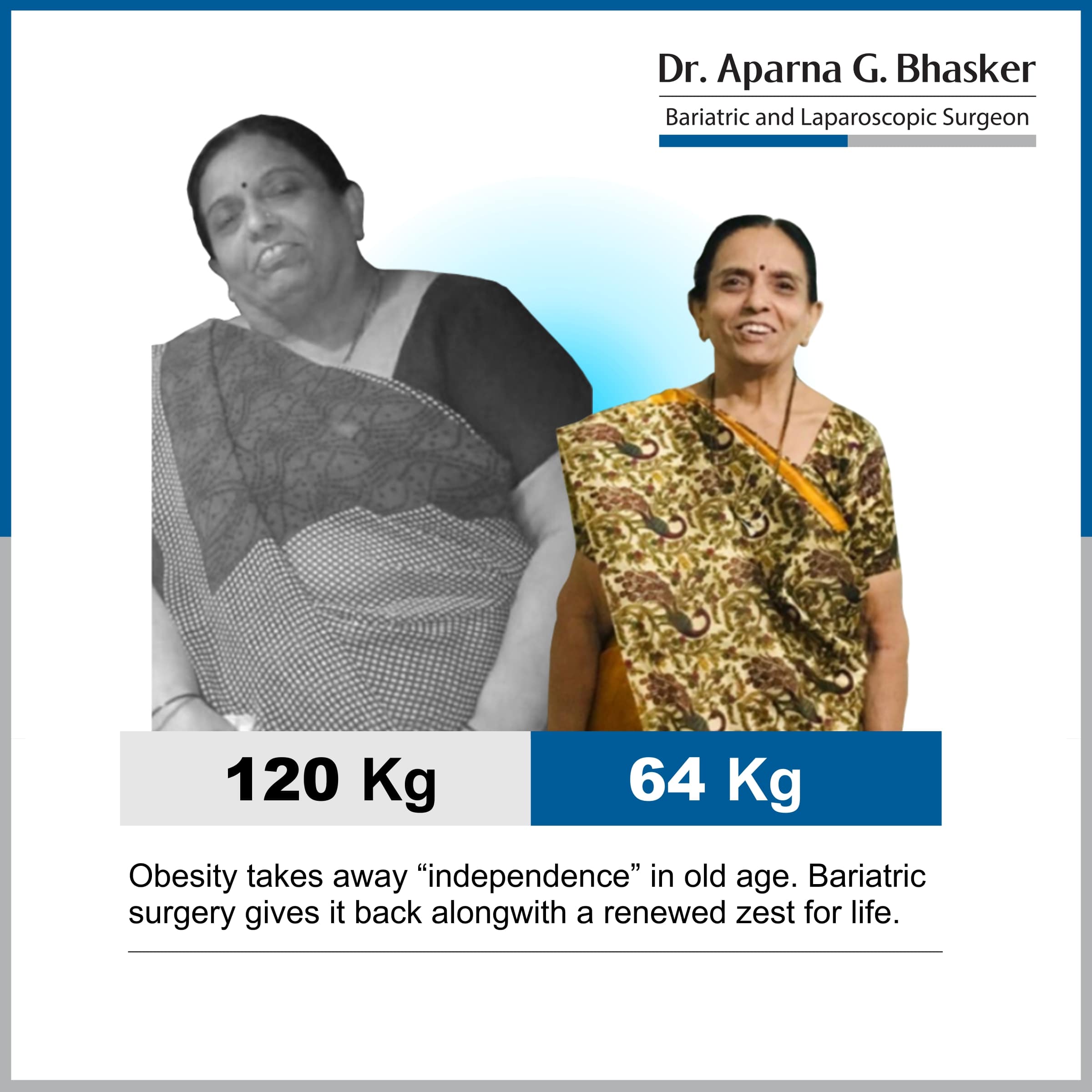 best Sleeve Gastrectomy with Duodeno Jejunostomy bariatric surgery and weight loss surgery cost in mumbai india before after photos (1)