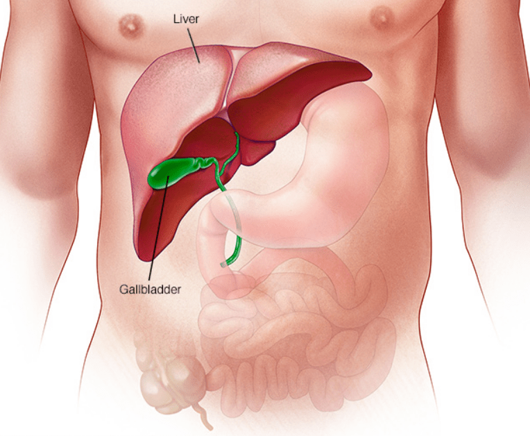 Gallbladder Removal, Gall Stone Surgery, Laparoscopic Cholecystectomy in Mumbai, India by Aparna Govil Bhasker