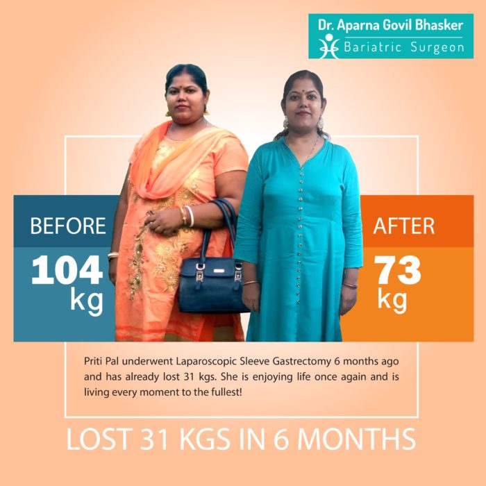 Best Bariatric Surgery Before After Photos, Weight Loss Surgery, Cost in Mumbai, India by Dr Aparna Govil Bhasker