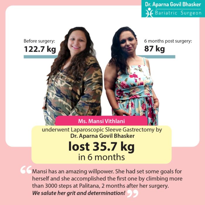 Best Bariatric Surgery Before After Photos, Weight Loss Surgery, Cost in Mumbai, India by Dr Aparna Govil Bhasker