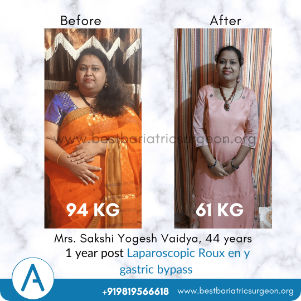 Laparoscopic Surgery Result