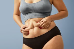 Common Myths And Misconceptions About Weight Loss Surgery And Sleeve Gastrectomy In Mumbai