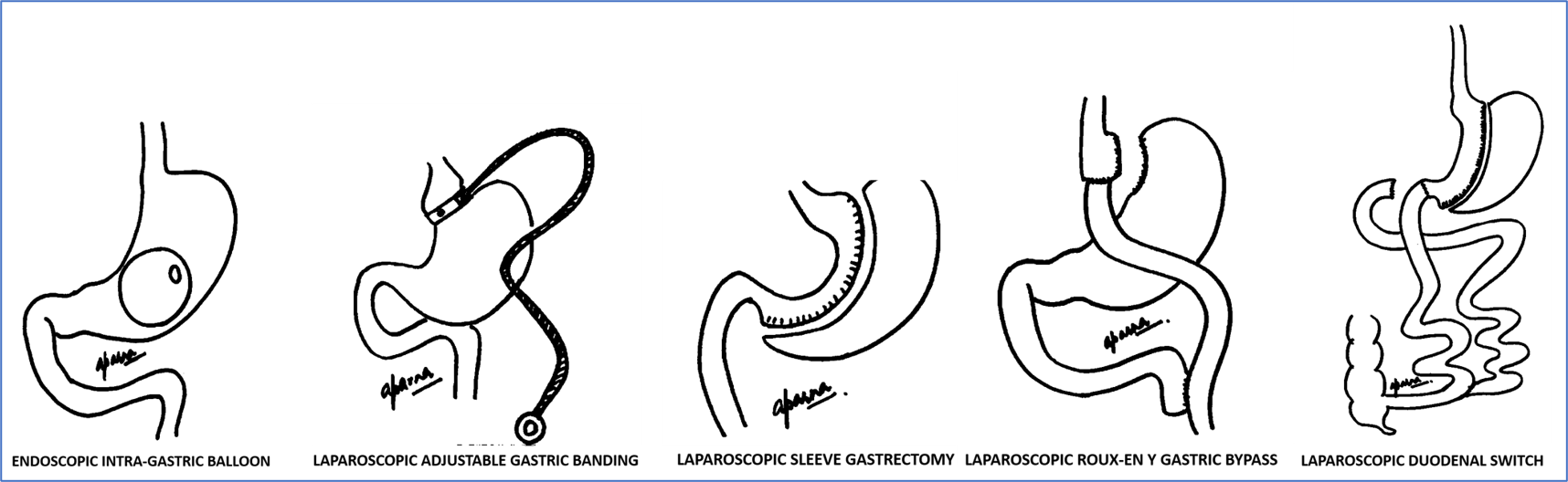All-surgeries