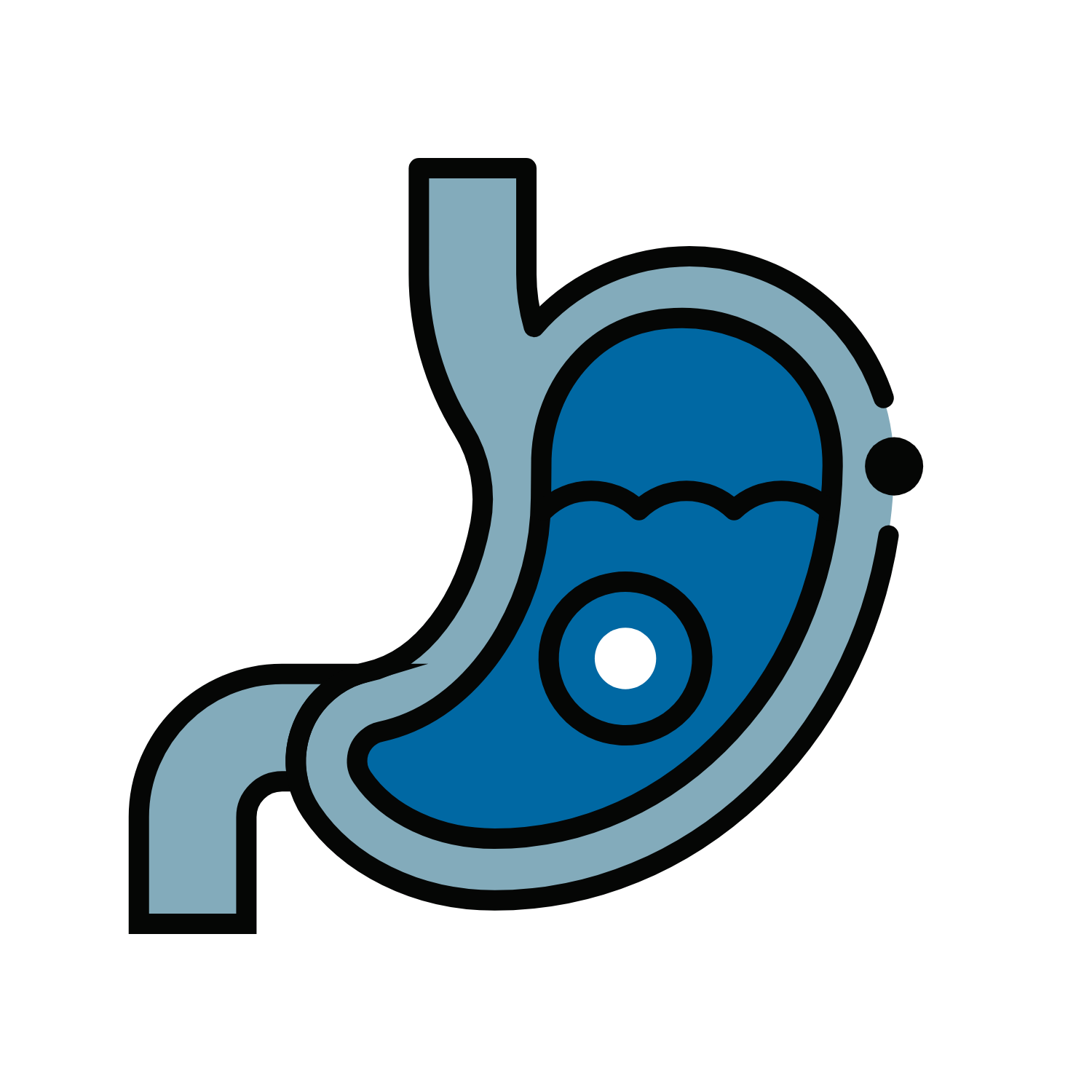 Intra-Gastric-Balloon-Insertion-Surgery