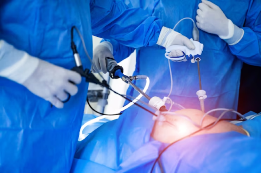 Gastric sleeve laparoscopic surgery
