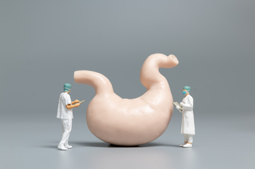 mini gastric bypass surgery