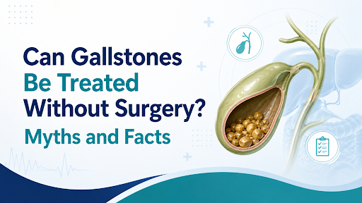 Gallstones Be Treated Without Surgery Gallstones Be Treated Without Surgery